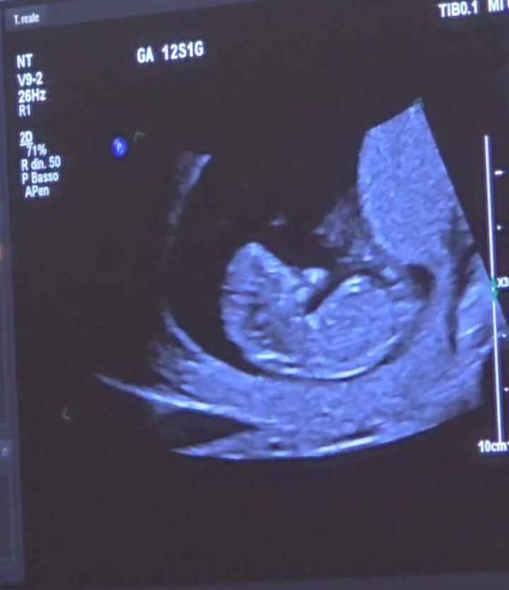 Esperte Nub Theory - 3