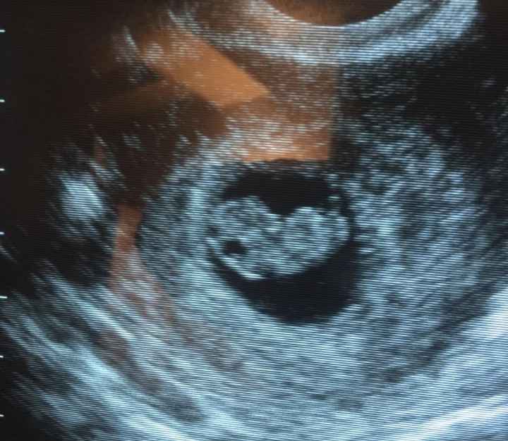 Future mamme di Aprile 2021 🐣 - 1