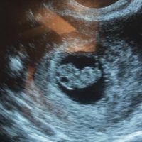 Future mamme di Aprile 2021 🐣 - 1