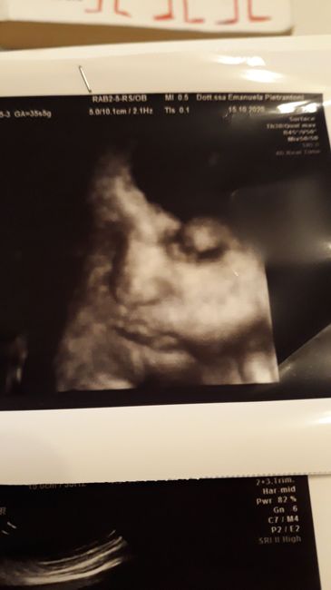 Future mamme novembre 2020 🌞🍁🌷♾ - 1