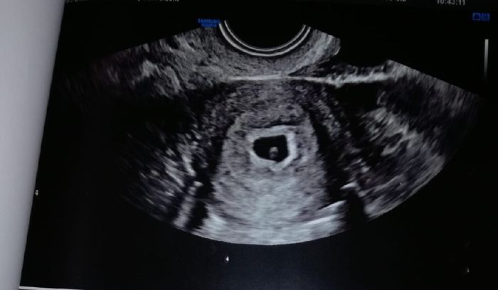 Future mamme novembre 2020 🌞🍁🌷♾ - 1