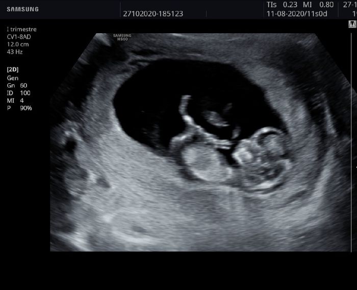Future Mamme Maggio 2021❤️ - 1