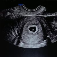 Future mamme novembre 2020 🌞🍁🌷♾ - 1