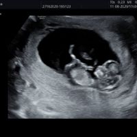 Future Mamme Maggio 2021❤️ - 1