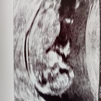 Nub theory. Maschio o femmina?💙🎀 - 1