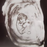 Nub theory 😂😂😂😂 - 1