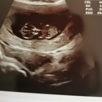 Nub theory 😂😂😂😂 - 1