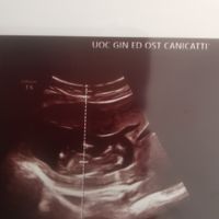 Nub theory. Maschio o femmina?💙🎀 - 1