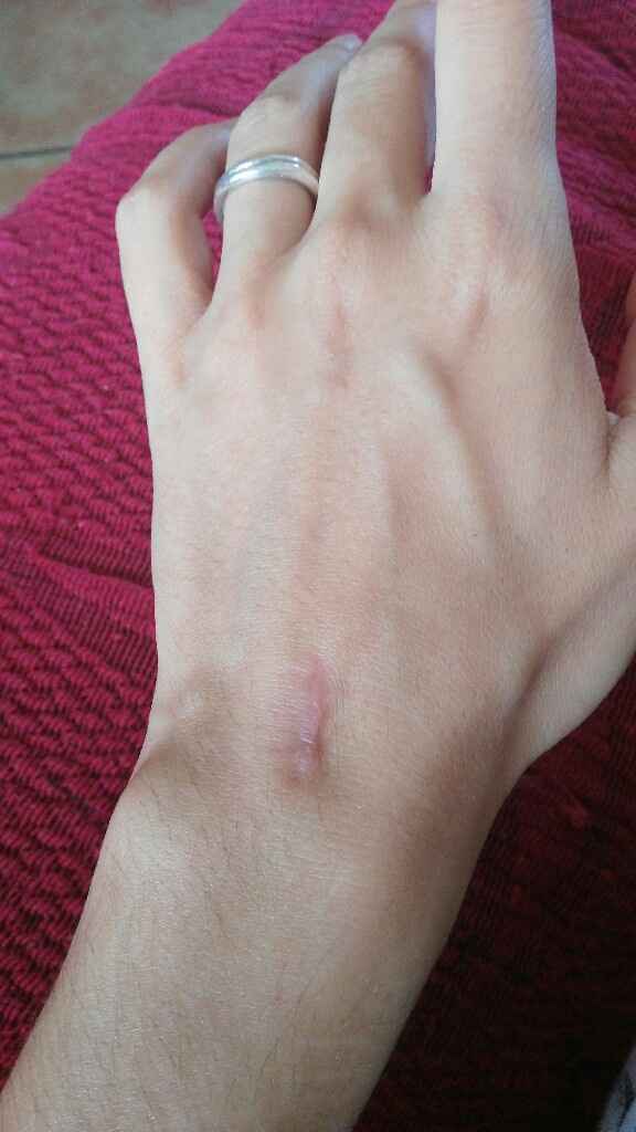 Piedi distrutti... Help! - 1