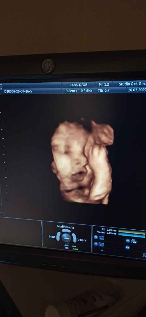 Mamme di Agosto 2020😍🤞😍 - 1