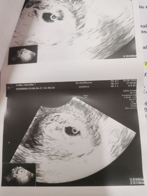 Future mamme di Aprile 2021 🐣 - 1