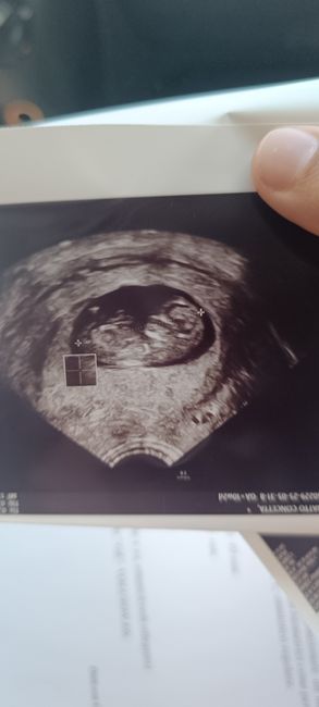 Future mamme Ottobre/Novembre/Dicembre 2025❤️ - 1