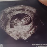 Future mamme Ottobre/Novembre/Dicembre 2025❤️ - 1