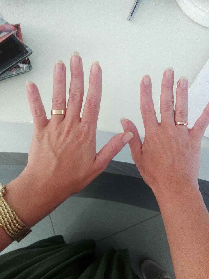 Fedi piatte, qualcuno le ha prese? - 1