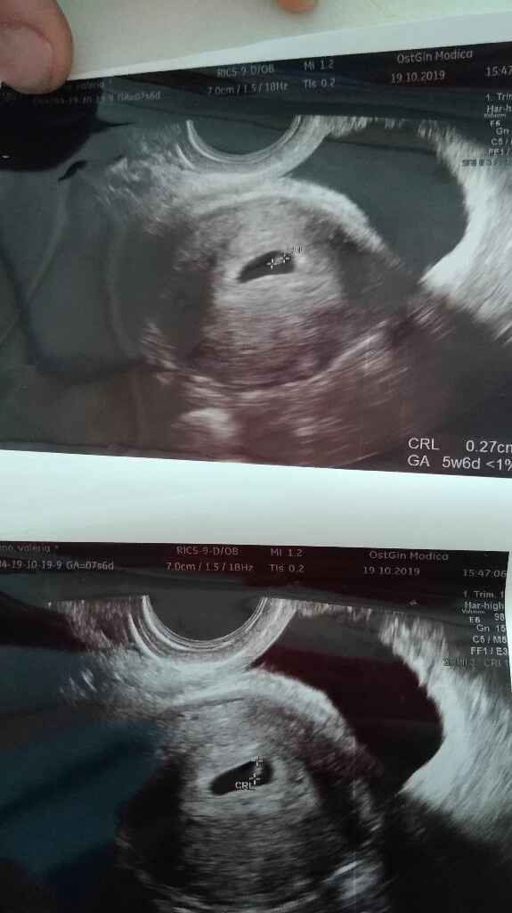 Maschio o femmina? - 1