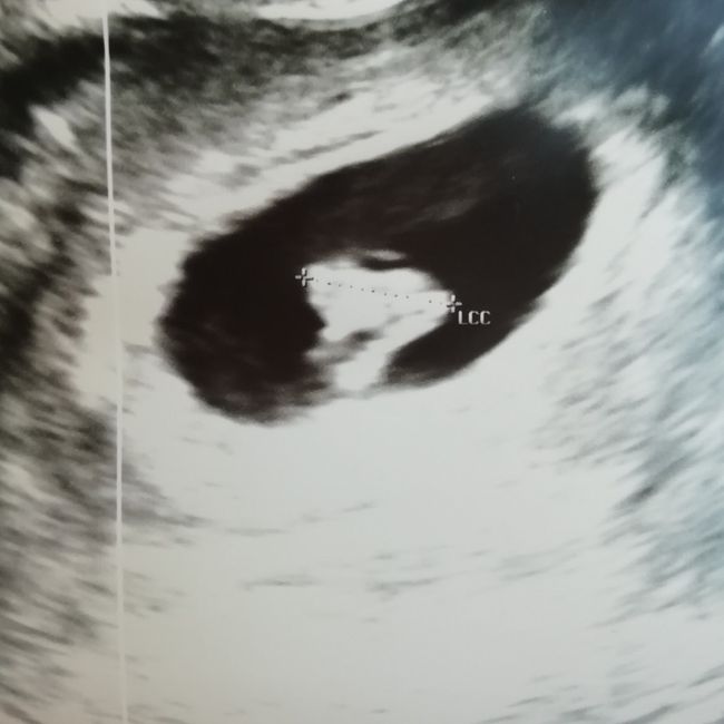 💙💜future mamme di Maggio 2022💙💜 - 1