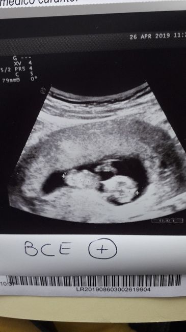 Future mamme di novembre 1