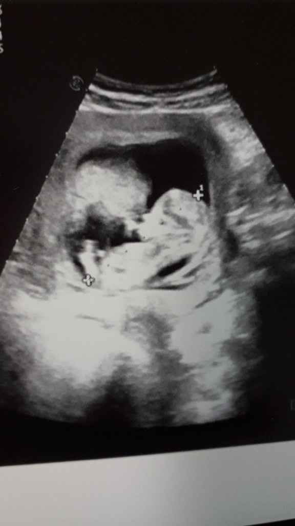 Future mamme di novembre - 1