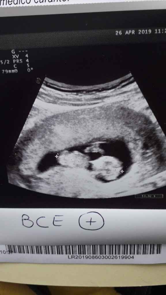 Maschio o femmina? - 1