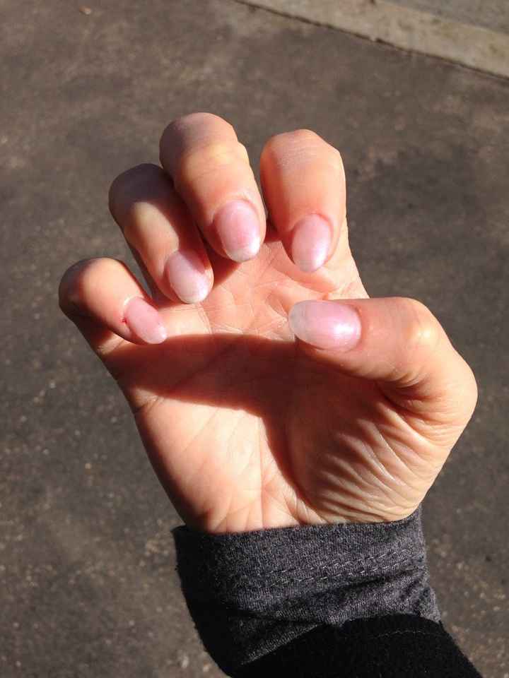 Unghie forse così - 1