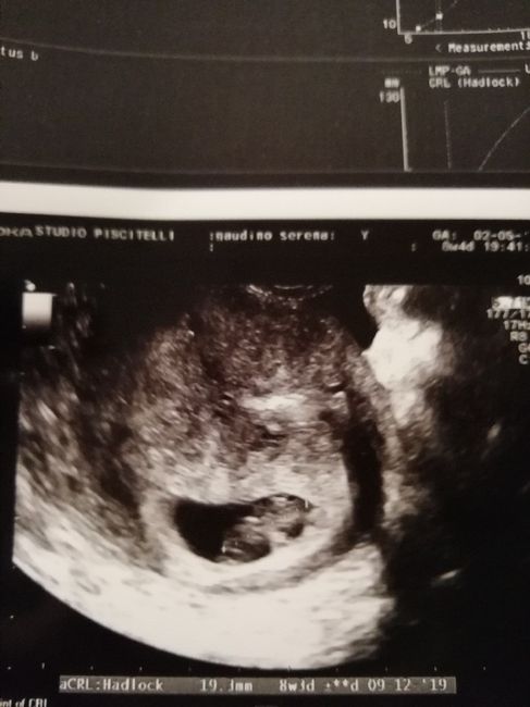 Future mamme "dicembrine" 2019 💙💗 - 1