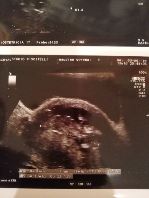 Future mamme "dicembrine" 2019 💙💗 - 1