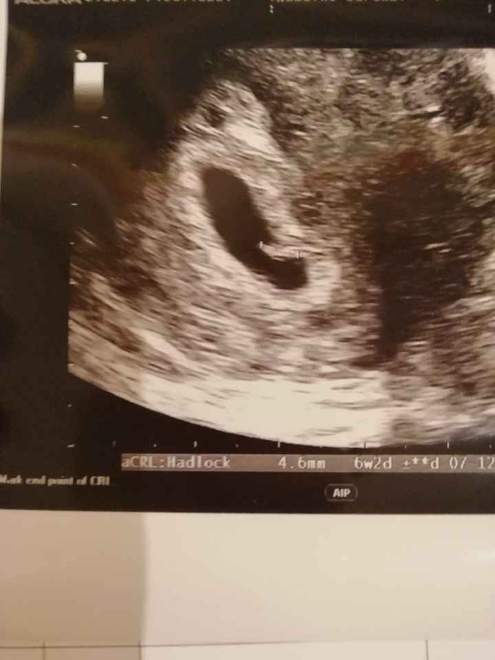 Future mamme "dicembrine" 2019 💙💗 - 1