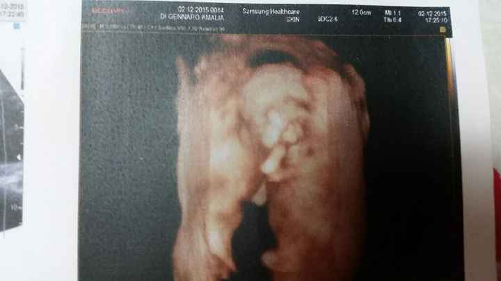 È un maschietto!!! - 1