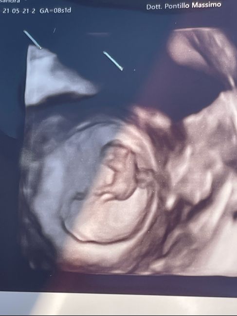 Future mamme Dicembre 2021 🎄🎁💙🎀 - 1