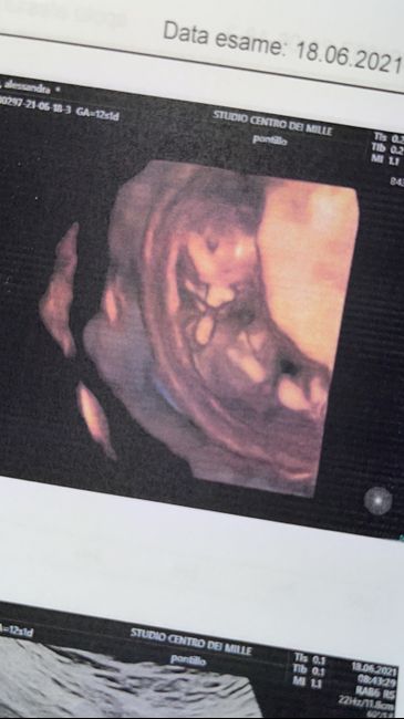Future mamme Dicembre 2021 🎄🎁💙🎀 - 1