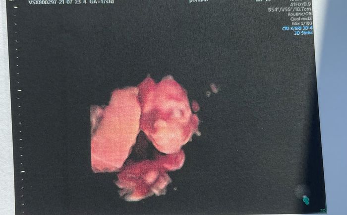 Future mamme Dicembre 2021 🎄🎁💙🎀 - 1