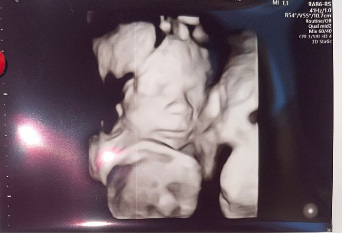Future mamme Dicembre 2021 🎄🎁💙🎀 - 1