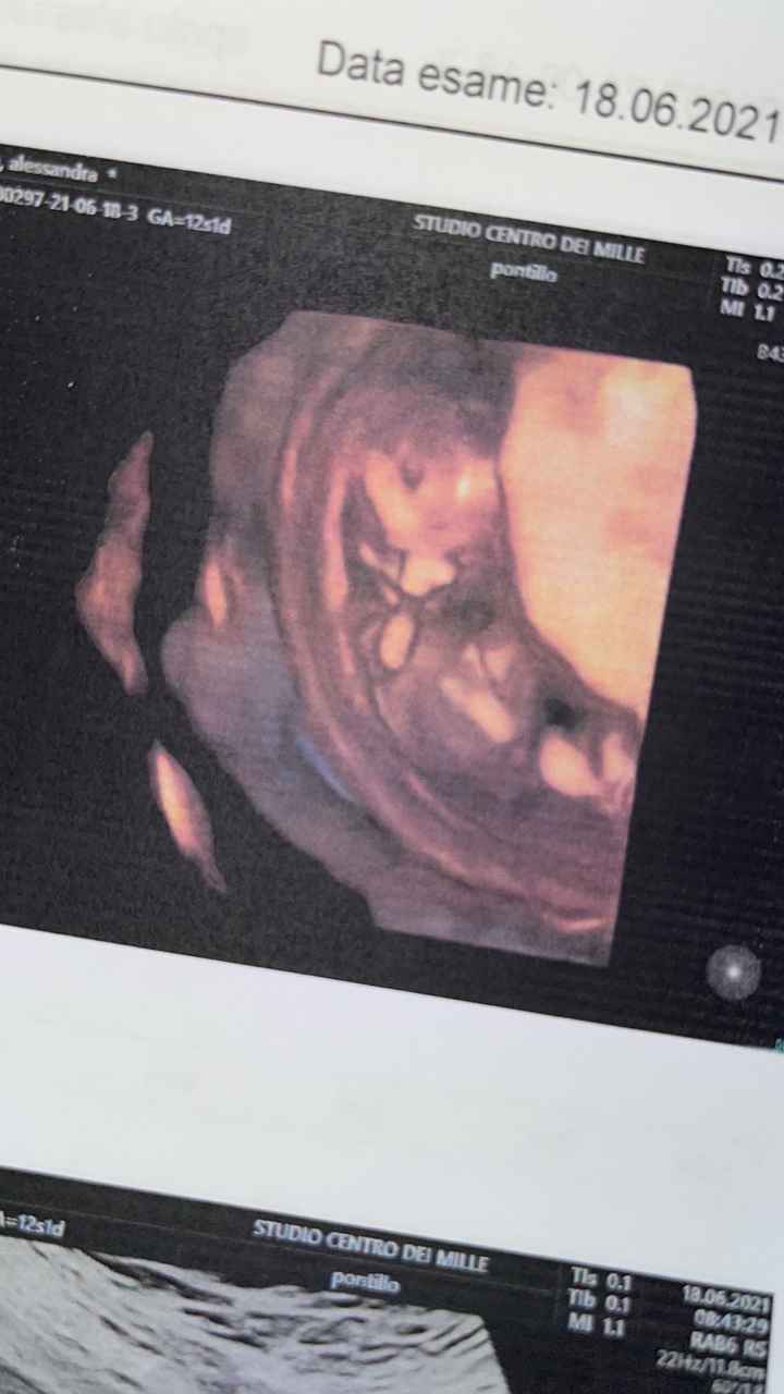 Future mamme Dicembre 2021 🎄🎁💙🎀 - 1