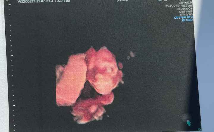 Future mamme Dicembre 2021 🎄🎁💙🎀 - 1