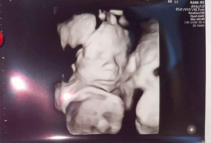 Future mamme Dicembre 2021 🎄🎁💙🎀 - 1