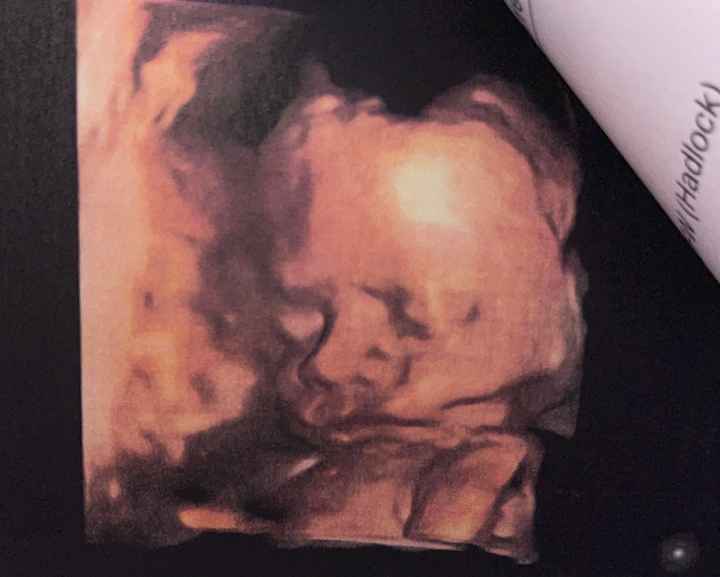 Future mamme Dicembre 2021 🎄🎁💙🎀 - 1