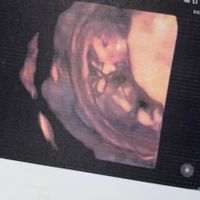 Future mamme Dicembre 2021 🎄🎁💙🎀 - 1