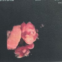Future mamme Dicembre 2021 🎄🎁💙🎀 - 1