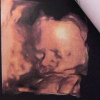 Future mamme Dicembre 2021 🎄🎁💙🎀 - 1