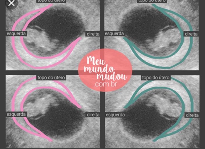 Metodo Ramzi cosa pensano le più esperte? 1