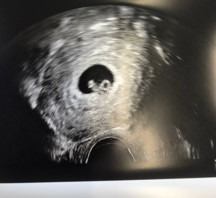 Metodo Ramzi cosa pensano le più esperte? 6