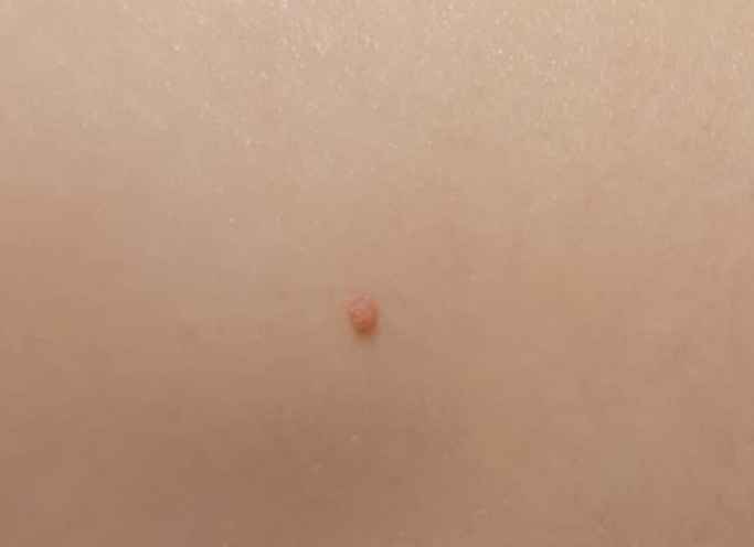 Un po preoccupata per il mio bimbo - 1