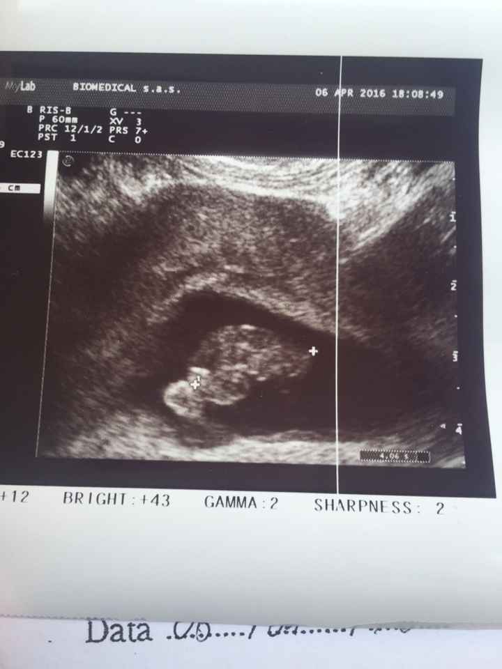 Vi presento il mio fagiolino/a - 1