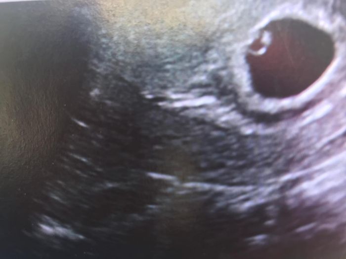Future mamme "dicembrine" 2019 💙💗 1