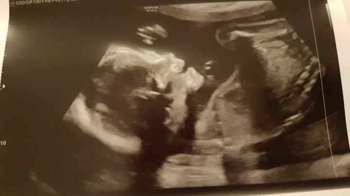 🍀Future mamme Luglio 2022🍀 - 1