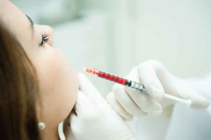 Ritocchini: sì o no? - 1