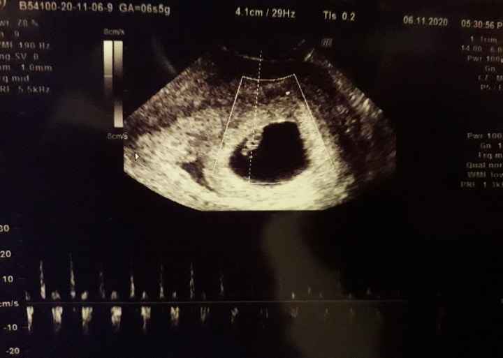 Il mio piccolo fagiolino❤ - 1