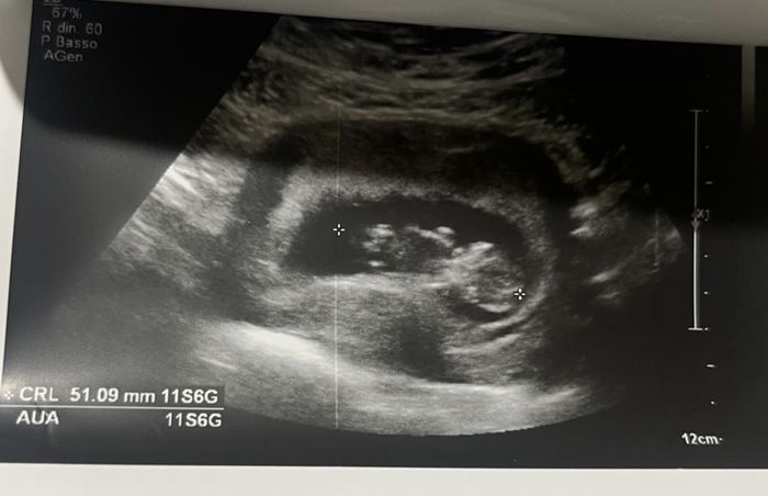 Future mamme Giugno/Luglio 2025 ❤️ 1