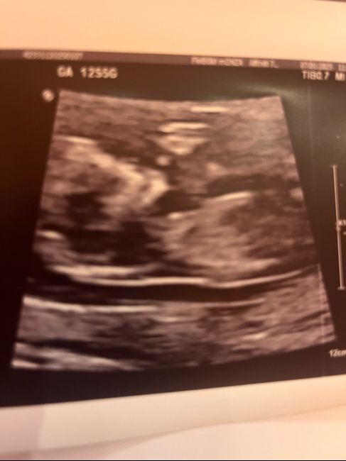 Future mamme Giugno/Luglio 2025 ❤️ 3