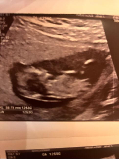 Future mamme Giugno/Luglio 2025 ❤️ 2